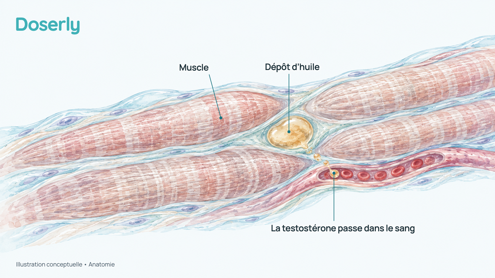 Illustration conceptuelle d’une petite flaque d’huile injectée entre des fibres musculaires, qui libère lentement de la testostérone vers un vaisseau sanguin voisin. Elle montre l’anatomie, pas un effet mesuré du médicament.