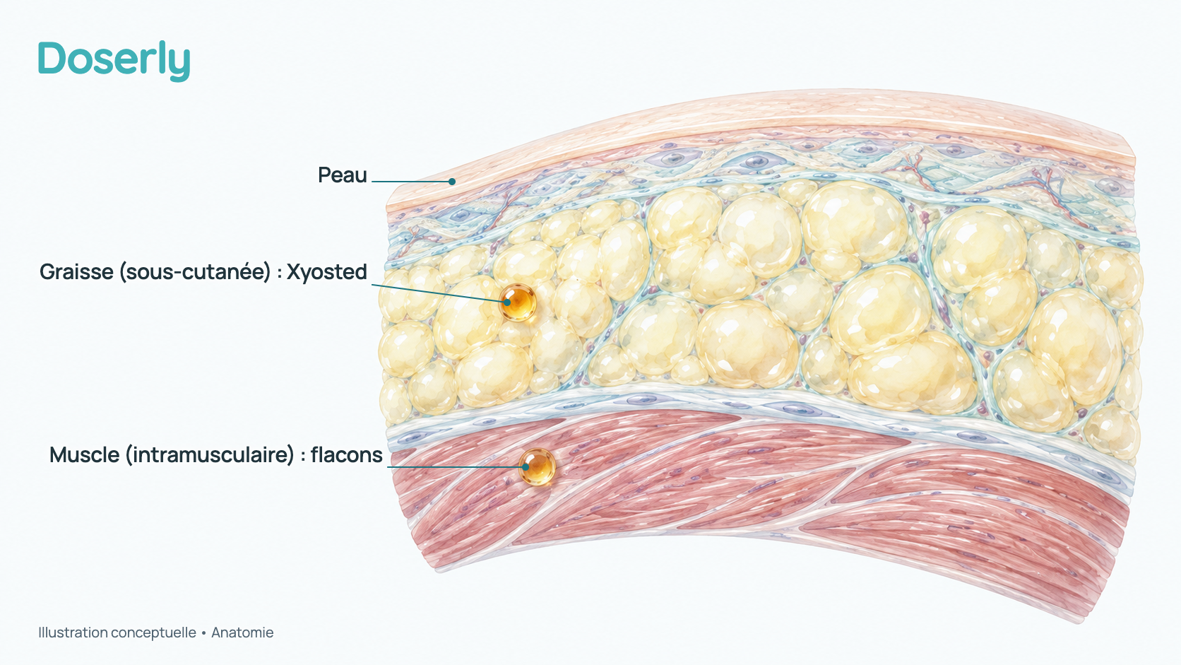 Coupe transversale conceptuelle de la paroi abdominale : la peau, une couche de graisse avec un dépôt d’huile (sous-cutané, comme avec le Xyosted) et le muscle avec un autre (intramusculaire, comme avec les injections de flacons). Aucune aiguille ni aucun appareil n’est montré; l’image explique l’anatomie, pas la technique d’injection.