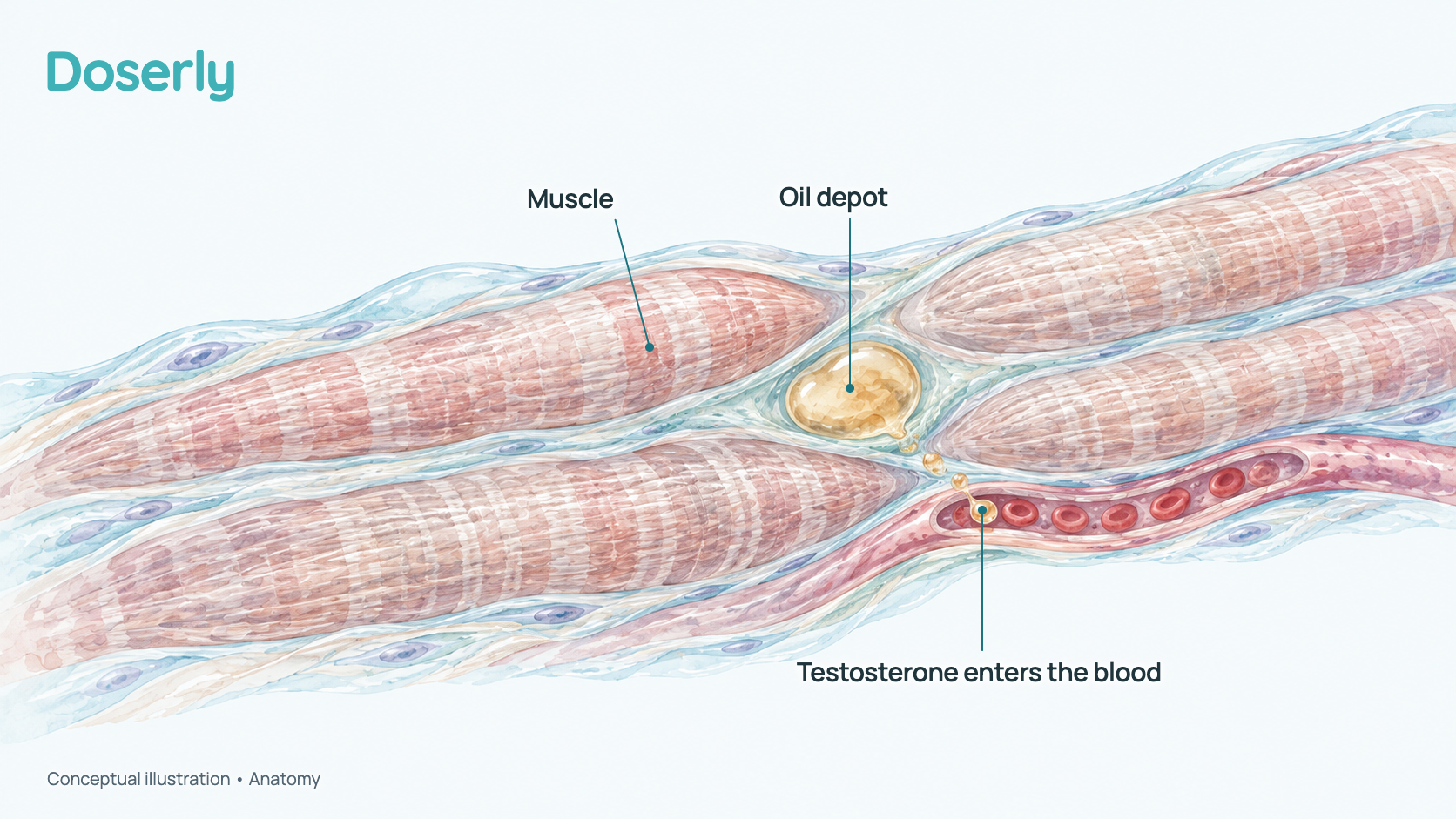 Conceptual illustration of a small pool of injected oil between muscle fibers, slowly releasing testosterone toward a nearby blood vessel. It shows anatomy, not a measured drug effect.
